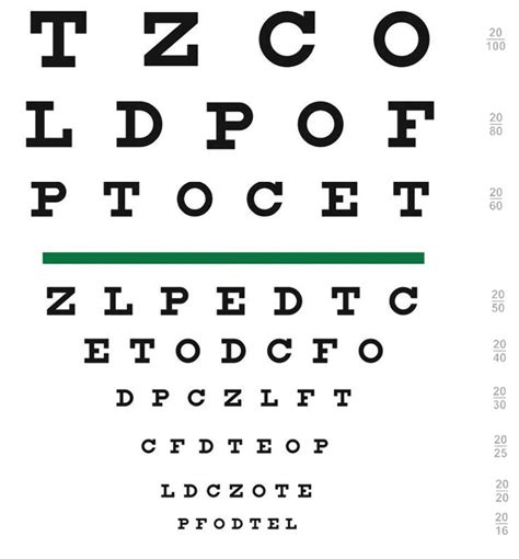 ONLINE Tools for Vision Screening – Edsel Ing: Eyelid Strabismus Orbit ...