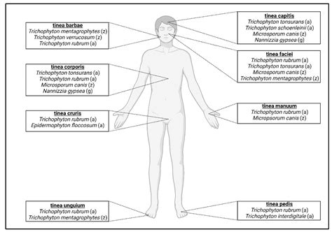 Pathogens | Free Full-Text | Current Topics in Dermatophyte Classification and Clinical Diagnosis