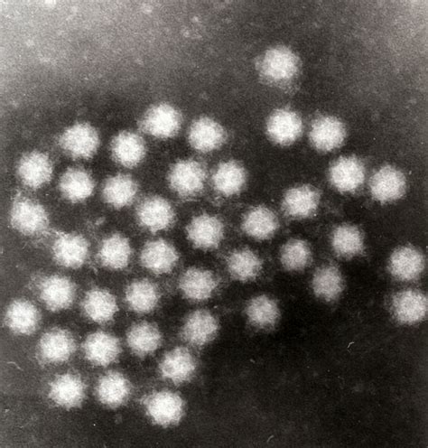 Sapovirus