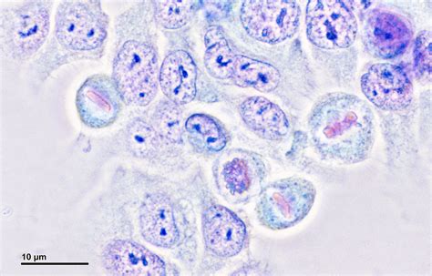 What is the Difference Between HeLa Cells and Normal Cells | Compare the Difference Between ...