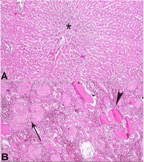 A -Photomicrograph of the liver showing centrilobular necrosis... | Download Scientific Diagram