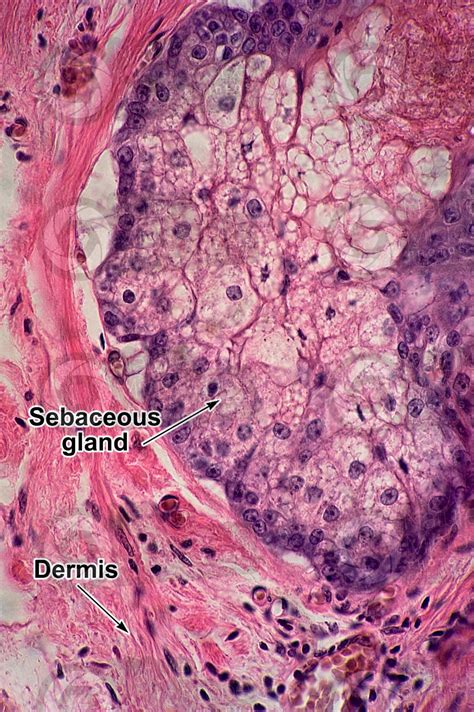 Sebaceous Glands Histology