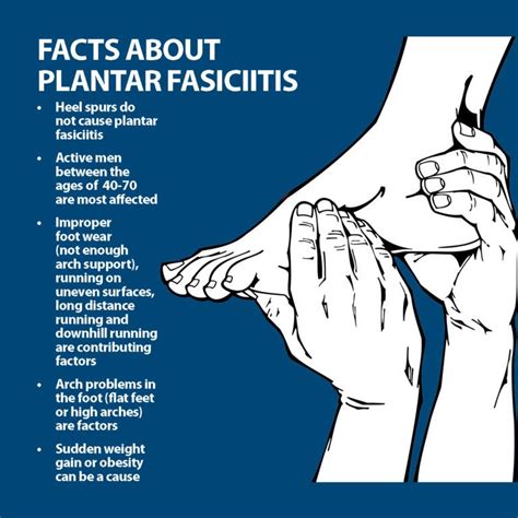 Plantar Fasciitis Info | Florida Orthopaedic Institute