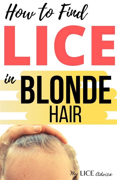 Lice in Blonde Hair: Lice Eggs, Pictures and Unique Challenges | Lice eggs, Hair lice, Lice spray
