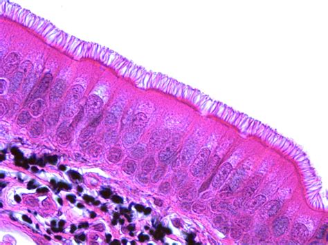 Pseudostratified Ciliated Columnar Epithelium | Human anatomy and physiology, Tissue types ...