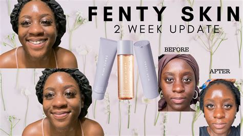 FENTY SKIN Review- With Before & After Pics! - YouTube