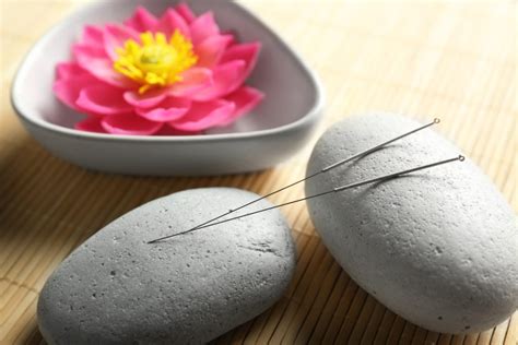 Acupuncture - Higher Health Naturopathic Centre and IV Lounge