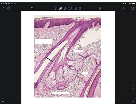 Skin histology slide 2 Quiz