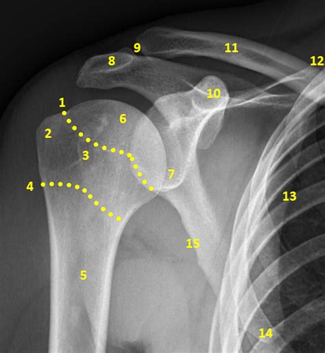 Scapula Anatomy Xray