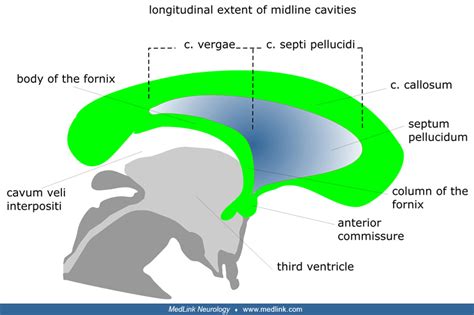 Cavum Velum Interpositum Ultrasound