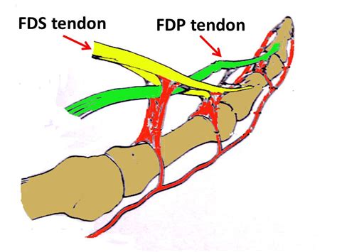 Flexor Tendon Injuries