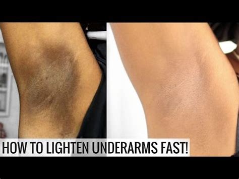 How To Lighten Dark Underarms Naturally and Fast | BEFORE AND AFTER ...