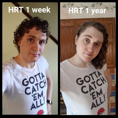 1 year on hormones today! MTF, 26-27 : r/transtimelines