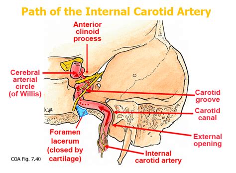 carotid canal | Internal carotid artery, Carotid artery, Cranial nerves