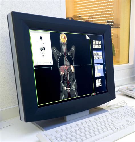 How do I Interpret my PET Scan Results? (with pictures)