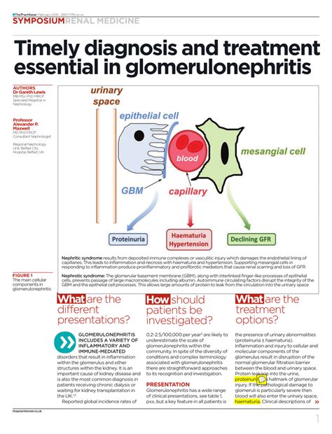 (PDF) Timely diagnosis and treatment essential in glomerulonephritis