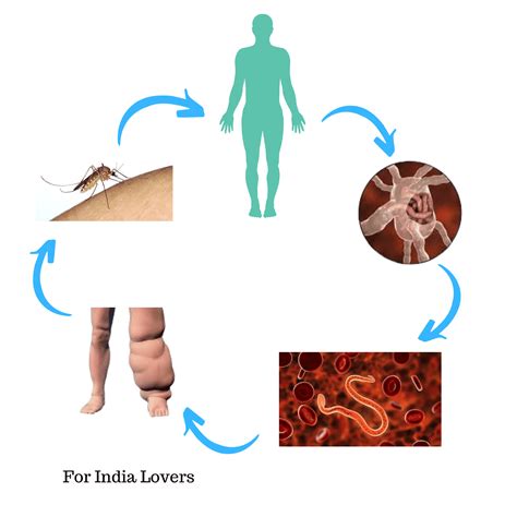 Lymphatic Filariasis - For India Lovers