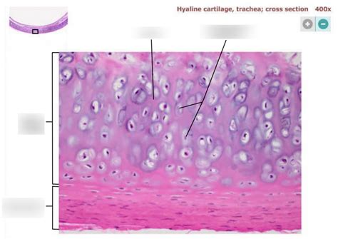 hyaline cartilage - trachea Diagram | Quizlet