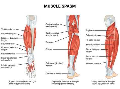 Fibularis Longus Trigger Point