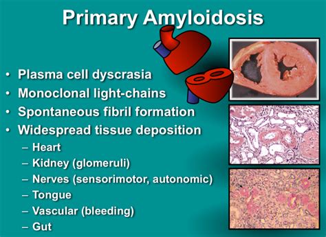 Amyloidosis : Causes ,Types, Symptoms, Treatments & Prognosis » How To Relief