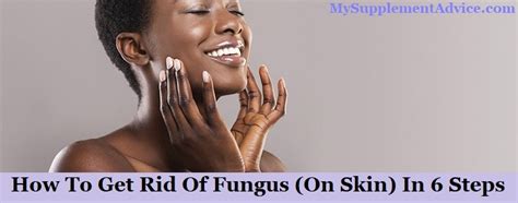 How To Get Rid Of Fungus (On Skin) In 6 Steps - Supplementox