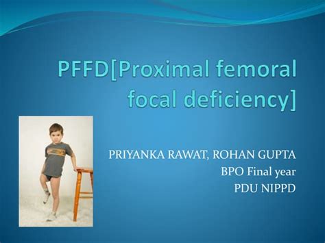 PFFD [proximal femoral focal deficiency] | PPT