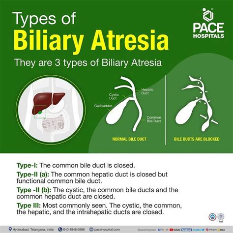 Biliary Atresia Symptoms, Causes, Types & Complications