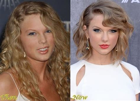 Taylor Swift before and after plastic surgery 04 | Celebrity plastic surgery online