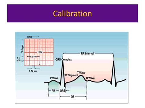 PPT - ECG interpretation PowerPoint Presentation - ID:6545321