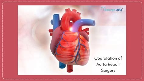 Coarctation Of Aorta Repair Surgery Kosten yn Yndia | Proseduere ...