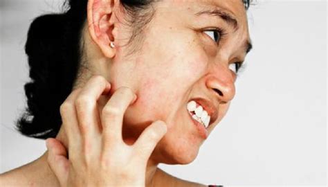 7 itchy acne Effects and Its Causes - Guide For Your Skin Problem