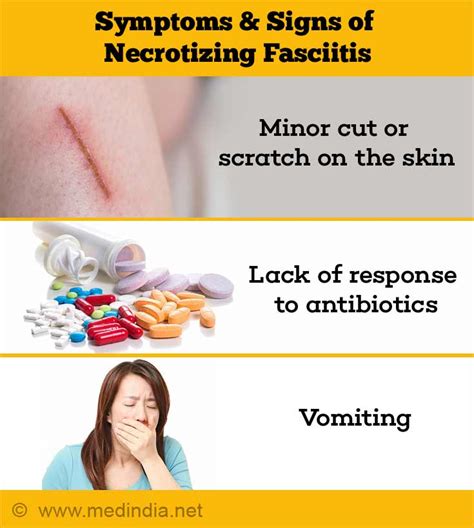 Necrotizing Fasciitis (NF) | Flesh-Eating Disease - Causes, Risk ...