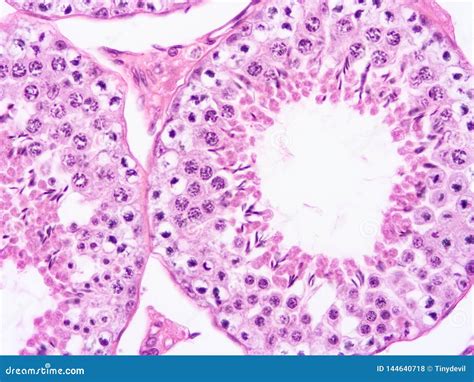 Histology of Testis Human Tissue Stock Photo - Image of human, cuboidal: 144640718