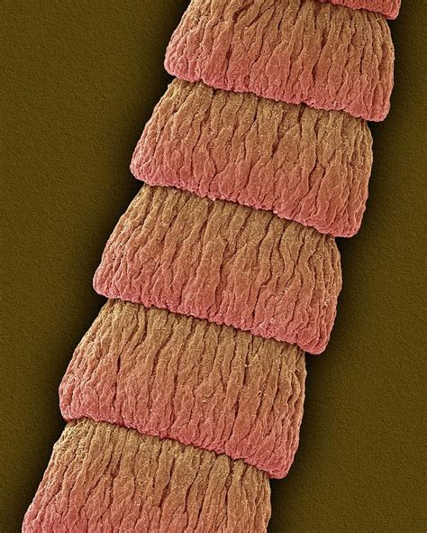 Dog Tapeworm Proglottids (dipylidium Caninum) Photograph by Dennis Kunkel Microscopy/science ...