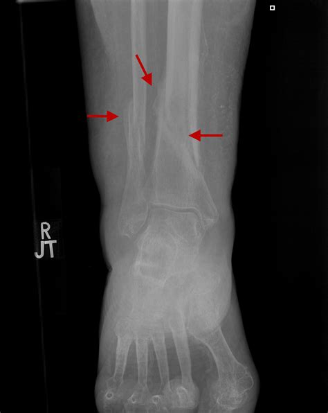 On Call Radiology - common radiology findings on call and in the Emergency Room and during the ...