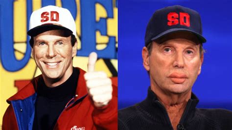 Super Dave's Plastic Surgery: What Happened to Bob Einstein's Lips? Is It Real or Fake?