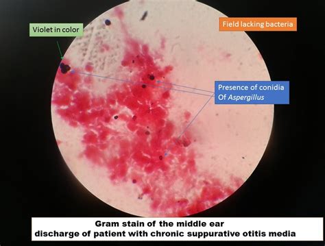 Aspergillus Conidiophores Gram Stain