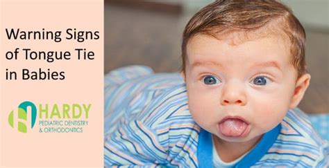 Warning Signs of Tonge-Tie in Infants - Hardy Orthodontics