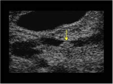 Abdomen and retroperitoneum | 1.2 Gallbladder and bile ducts : Case 1.2 ...