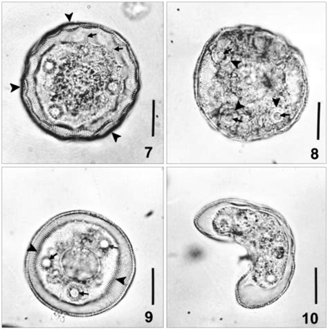 Photomicrographs of Arcella excavata. 7-aboral view, showing shell ...