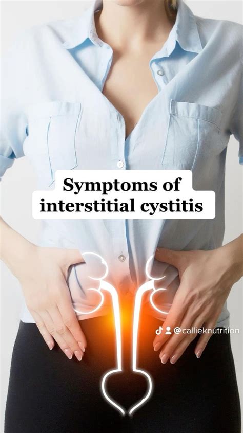 Pin on Interstitial Cystitis