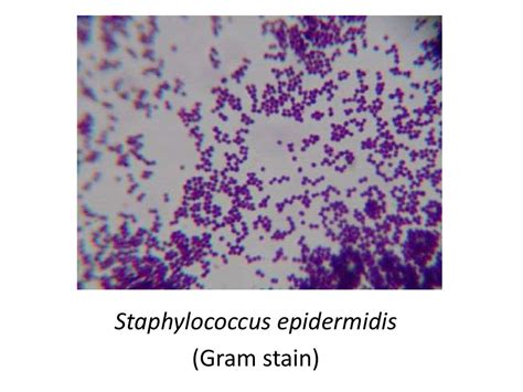 Staphylococcus Epidermidis Gram Stain