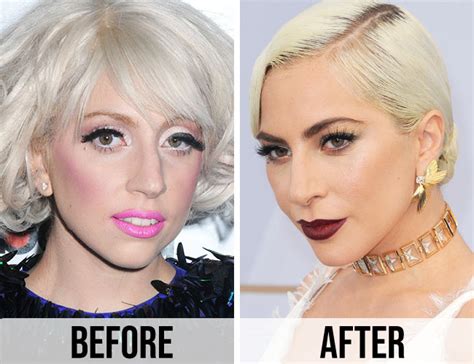 Lady Gaga Doesn’t Even Look Like Herself Anymore—Her Face Has Changed ...