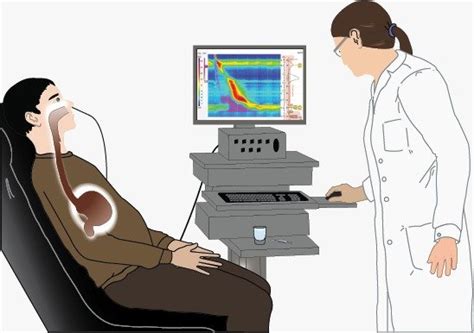 Understanding Achalasia Cardia: Causes, Symptoms, Diagnosis, and ...