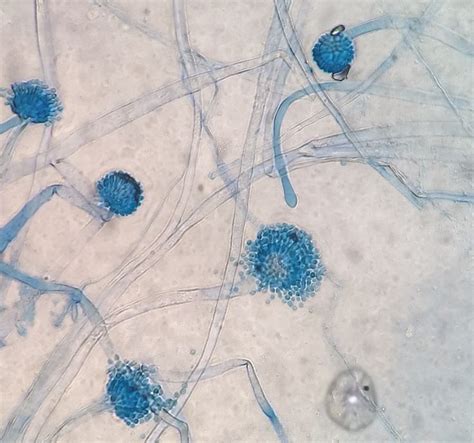 Aspergillus flavus. I think this picture kind of highlights both the uniseriate and biseriate ...