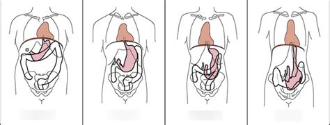 Body Habitus Diagram | Quizlet