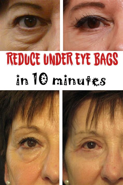 How to reduce under eye bags in 10 minutes - Glamorous Girls | Como peinarme, Bajo los ojos ...