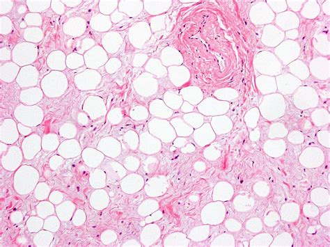 histologyolm.stevegallik.org...great pictures of all kinds of tissues | Adipose tissue, Adipose ...