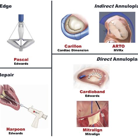 (PDF) Patient selection for trans-catheter mitral valve repair vs ...