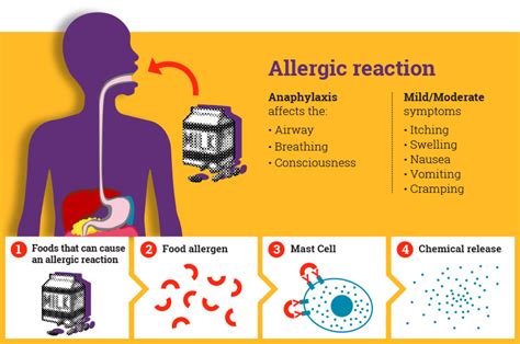 Clipart Of Anaphylaxis